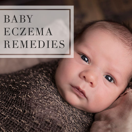 Baby eczema: causes, symptoms, treatments and creams ...