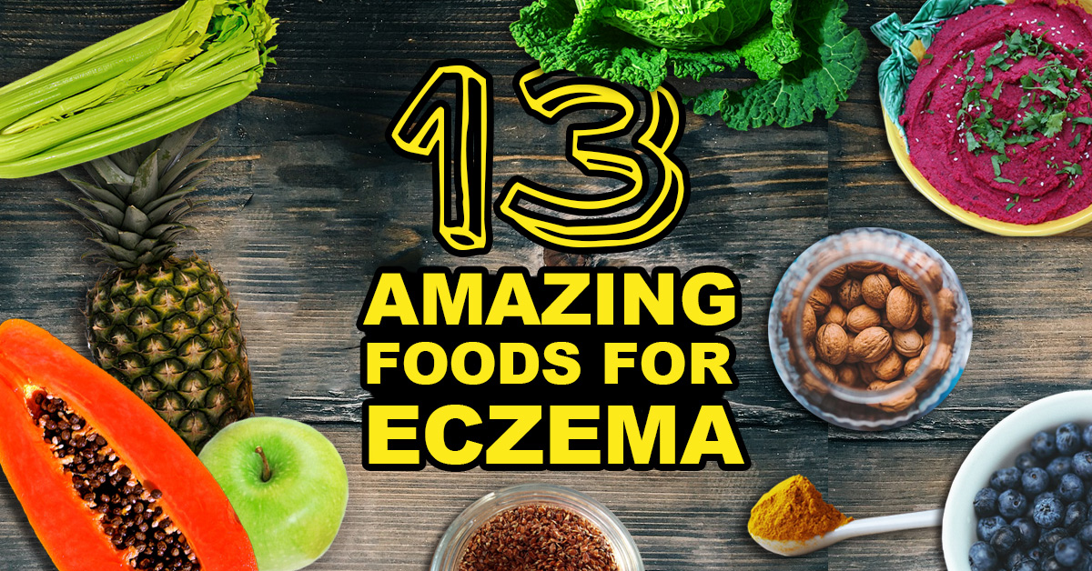 13 Good Foods For Eczema Sufferers 