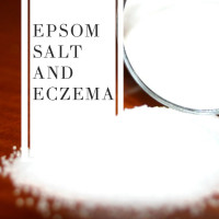 Epsom Salt and Eczema