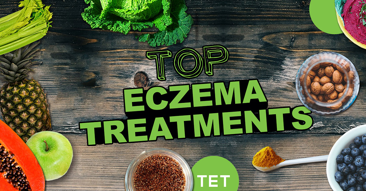 Top Eczema Treatments - Your Guide to Eczema Recovery