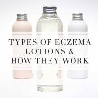 Eczema Lotions and Creams and How They Work