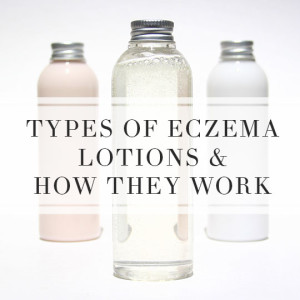 Types of eczema lotions and how they work