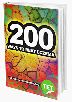 200 Ways to Beat Eczema eBook