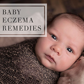 Baby Eczema Remedies