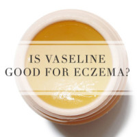 Is Vaseline Good For Eczema?
