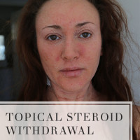 What is Topical Steroid Withdrawal?