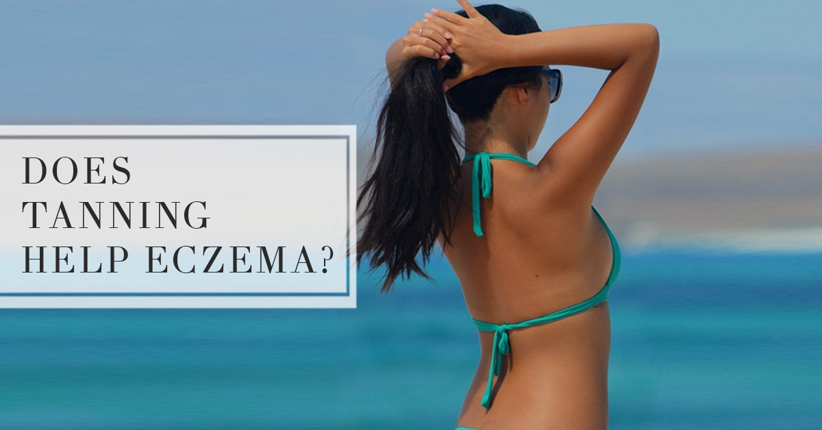 Does Tanning Help Eczema Top Eczema Treatments