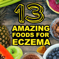 13 Good Foods for Eczema Sufferers