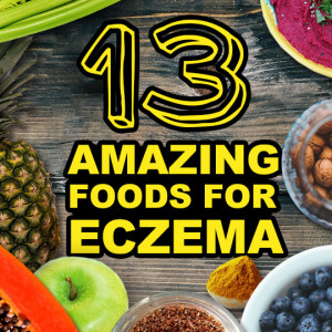 13 Super Foods Good for Eczema