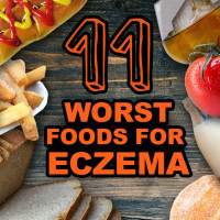 11 Foods to Avoid with Eczema and TSW
