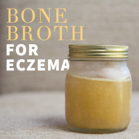5 Amazing Benefits of Bone Broth for Eczema Sufferers