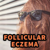 Follicular Eczema